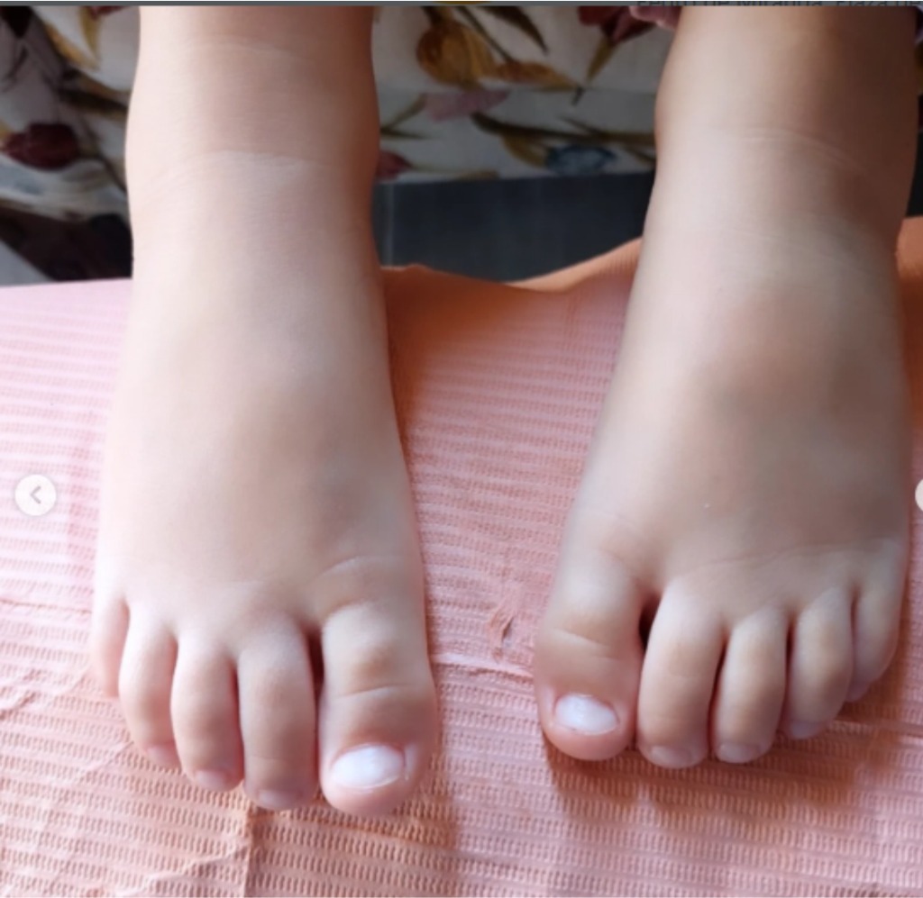 Cuidado podológico en niños Podofran
